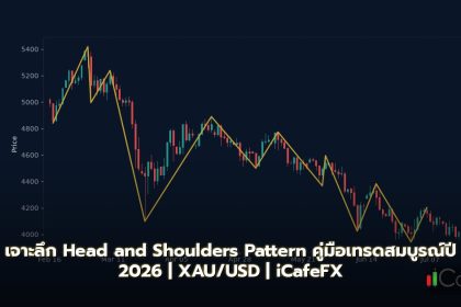 Head and Shoulders Pattern — คู่มือฉบับสมบูรณ์ 2026