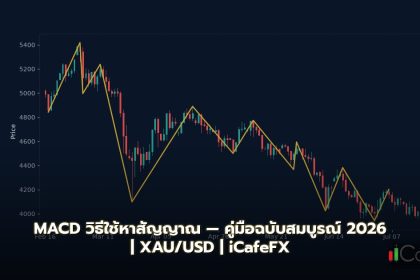 MACD วิธีใช้หาสัญญาณ — คู่มือฉบับสมบูรณ์ 2026